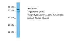 CTPS2 Rabbit anti-Human, Polyclonal, Novus Biologicals 0.1 mL | Buy Online | Novus Biologicals | Fisher Scientific